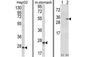 (LEFT) Western blot analysis of GSTA1 Antibody in HepG2 cell line lysates (35ug/lane). (GSTA1 anticorps)