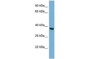 Host: Rabbit Target Name: TWF2 Antibody Dilution: 1. (TWF2 anticorps  (N-Term))