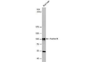 WB Image Factor B antibody [N2C2], Internal detects Factor B protein by western blot analysis.