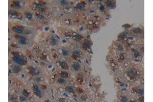 Detection of PSMD9 in Human Liver Tissue using Polyclonal Antibody to Proteasome 26S Subunit, Non ATPase 9 (PSMD9)