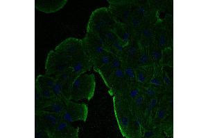 Immunofluorescence - anti-beta-Actin Ab at 1/100 dilution in NHl/3T3 cells, cells were fixed with methanol and permeabilized with 0. (beta Actin anticorps  (N-Term))