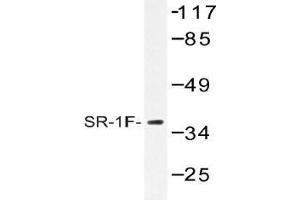 Western blot (WB) analysis of SR-1F antibody in extracts from COS-7 cells. (HTR1F anticorps)