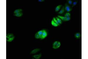 Immunofluorescence staining of HepG2 cells with ABIN7151234 at 1:66, counter-stained with DAPI. (TRAF7 anticorps  (AA 1-90))