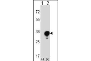 Western blot analysis of YWHAG (arrow) using rabbit polyclonal YWHAG Antibody (Center) (ABIN389486 and ABIN2839545).