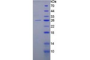 SDS-PAGE analysis of Human Keratin 8 Protein. (KRT8 Protéine)