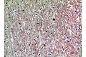 Immunohistochemical analysis of paraffin-embedded human-brain, antibody was diluted at 1:200 (ADAMTS18 anticorps  (AA 1030-1110))