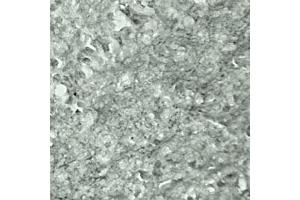 IHC on mouse brain (cryo section) using Rabbit antibody to Synaptotagmin 17  at a concentration of 50 µg/ml incubated overnight at 4C. (SYT17 anticorps  (Internal Region))