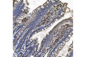 IHC analysis of LPP using anti LPP antibody (ABIN7602831).