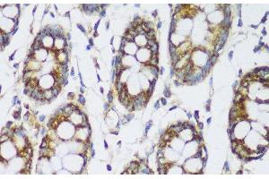 Immunohistochemistry of paraffin-embedded Human colon using ECH1 Polyclonal Antibody at dilution of 1:150 (40x lens). (ECH1 anticorps)