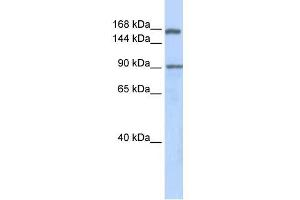 Human Lung; WB Suggested Anti-AFF2 Antibody Titration: 0.