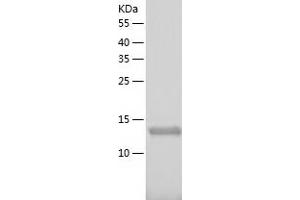 Western Blotting (WB) image for XiAP Associated Factor 1 (XAF1) (AA 1-125) protein (His-IF2DI Tag) (ABIN7125752)