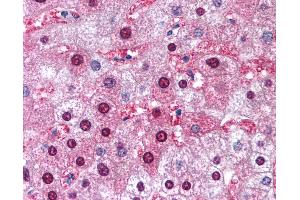 Anti-GSTM1 antibody IHC of human liver. (GSTM1 anticorps  (AA 31-80))