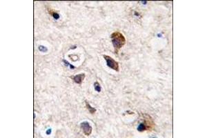 Formalin-fixed and paraffin-embedded human brain tissue reacted with PKC gamma antibody (C-term), which was peroxidase-conjugated to the secondary antibody, followed by DAB staining. (PKC gamma anticorps  (C-Term))