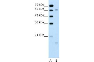 WB Suggested Anti-CYP4A22 Antibody Titration:  0. (CYP4A22 anticorps  (N-Term))