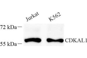 Western blot analysis of Cdkal1 (ABIN7073414) at dilution of 1: 400 (CDKAL1 anticorps)
