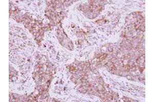 Image no. 1 for anti-Eukaryotic Translation Elongation Factor 1 delta (Guanine Nucleotide Exchange Protein) (EEF1D) (AA 310-647) antibody (ABIN1497948)