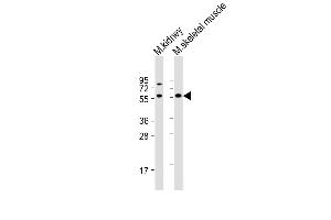 All lanes : Anti-Acvr2b Antibody (Center) at 1:1000 dilution Lane 1: mouse kidney lysate Lane 2: mouse skeletal muscle lysate Lysates/proteins at 20 μg per lane. (ACVR2B anticorps  (AA 148-176))