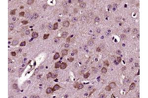 Paraformaldehyde-fixed, paraffin embedded mouse brain, Antigen retrieval by boiling in sodium citrate buffer (pH6) for 15min, Block endogenous peroxidase by 3% hydrogen peroxide for 30 minutes,  Blocking buffer (normal goat serum) at 37°C for 20min, Antibody incubation with Versican Polyclonal Antibody (bs-2533R) at 1:400 overnight at 4°C, followed by a conjugated secondary and DAB staining.