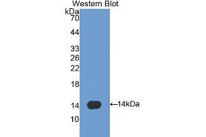 Western Blotting (WB) image for anti-Caveolin 1, Caveolae Protein, 22kDa (CAV1) (AA 2-105) antibody (ABIN1172557) (Caveolin-1 anticorps  (AA 2-105))