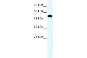WB Suggested Anti-FLJ31875 Antibody Titration:  1. (ZNF778 anticorps  (Middle Region))