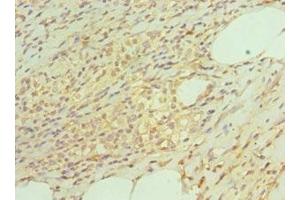 Immunohistochemistry of paraffin-embedded human epityphlon tissue using ABIN7164899 at dilution of 1:100 (TAC1 anticorps  (AA 1-129))