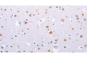 Immunohistochemistry of paraffin-embedded Human brain using HMGB3 Polyclonal Antibody at dilution of 1:30 (HMGB3 anticorps)