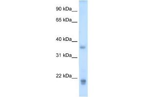 Growth Hormone 2 antibody used at 5 ug/ml to detect target protein. (Growth Hormone 2 anticorps  (Middle Region))