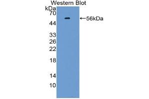 Western blot analysis of the recombinant protein. (KLF10/TIEG1 anticorps  (AA 1-210))