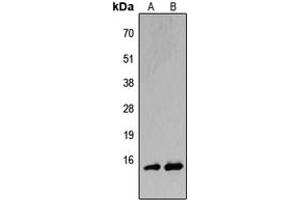 Western blot analysis of BATF expression in HeLa (A), H9C2 (B) whole cell lysates. (BATF anticorps  (N-Term))