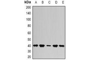 Western blot analysis of PSAT1 expression in Hela (A), SKOV3 (B), mouse kidney (C), mouse thymus (D), rat brain (E) whole cell lysates. (PSAT1 anticorps)