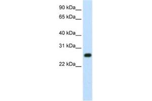 Western Blotting (WB) image for anti-MYC Induced Nuclear Antigen (MINA) antibody (ABIN2461954) (MINA anticorps)