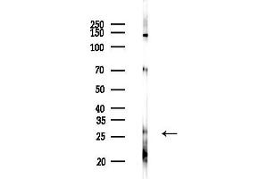 Western blot analysis of lysates from Mouse liver, using Hox Antibody at 1/1000 dilution.