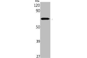 Western Blot analysis of rat kidney cells using Aladin Polyclonal Antibody (Adracalin anticorps  (C-Term))
