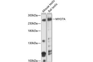 Western blot analysis of extracts of various cell lines, using MYO7A antibody (ABIN6129058, ABIN6144293, ABIN6144294 and ABIN6219050) at 1:3000 dilution.