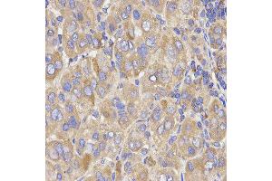Immunohistochemistry (IHC) image for anti-Kinesin Light Chain 1 (KLC1) antibody (ABIN1876732) (KLC1 anticorps)
