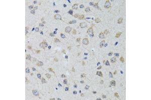 Immunohistochemistry of paraffin-embedded rat brain using HTR3A antibody.
