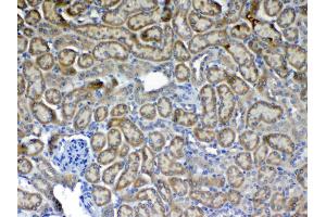 IHC analysis of Flt3 / CD135 using anti-Flt3 / CD135 antibody .