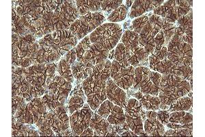 Image no. 4 for anti-Catenin (Cadherin-Associated Protein), beta 1, 88kDa (CTNNB1) antibody (ABIN1496898)