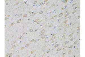 Immunohistochemistry of paraffin-embedded mouse brain using GARS antibody (ABIN5973156) at dilution of 1/100 (40x lens). (GARS anticorps)