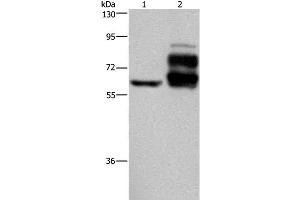 Western Blot analysis of Jurkat cell and Human rectal cancer tissue using PCSK9 Polyclonal Antibody at dilution of 1:200 (PCSK9 anticorps)