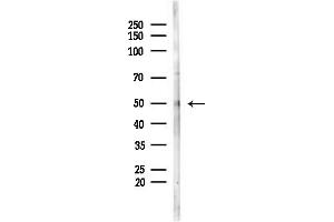 anti-LIM Homeobox Transcription Factor 1, alpha (LMX1A) (Internal Region) antibody