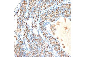 Immunohistochemistry of paraffin-embedded rat ovary using CYPOR Rabbit mAb (ABIN7269151) at dilution of 1:100 (40x lens). (POR anticorps)