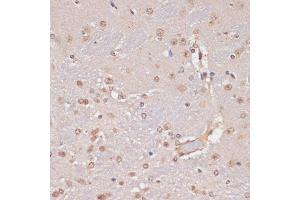 Immunohistochemistry of paraffin-embedded mouse brain using PIDD antibody (ABIN1680710, ABIN3019230, ABIN3019231, ABIN5664897 and ABIN6220775) at dilution of 1:100 (40x lens). (PIDD anticorps  (AA 1-85))