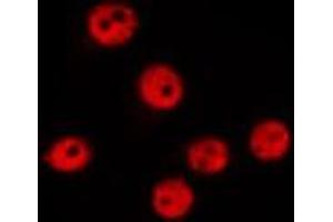 ABIN6275068 staining HepG2 by IF/ICC.