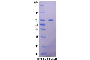 SDS-PAGE analysis of Mouse SDHA Protein. (SDHA Protéine)