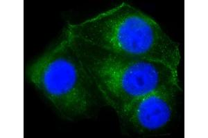 Immunofluorescent analysis of 4 % paraformaldehyde-fixed, 0. (Cathepsin D anticorps  (AA 1-412))