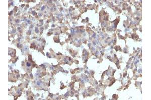 Image no. 1 for anti-Tumor Necrosis Factor alpha (TNF alpha) antibody (ABIN6171941) (TNF alpha anticorps)