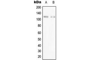 Western blot analysis of PPFIBP1 expression in Jurkat (A), HEK293T (B) whole cell lysates. (PPFIBP1 anticorps  (Center))