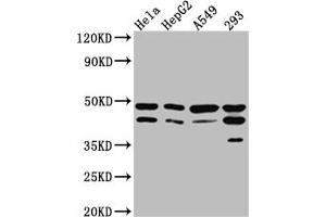 Western Blot Positive WB detected in: Hela whole cell lysate, HepG2 whole cell lysate, A549 whole cell lysate, 293 whole cell lysate All lanes: GSK3 beta Antibody at 1:1000 Secondary Goat polyclonal to rabbit IgG at 1/50000 dilution Predicted band size: 47, 49 kDa Observed band size: 47 kDa (Recombinant GSK3 beta anticorps)