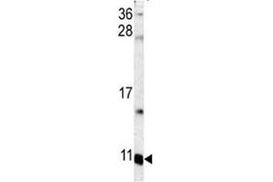 Western blot analysis of S100A6 antibody and mouse lung tissue lysate.
